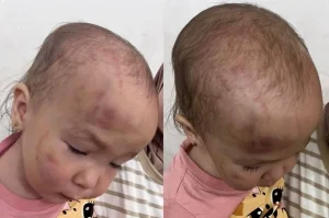 Жеке балабақшада бір жарым жасар қызға балалардың бірі зәбір көрсеткен