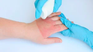 Мектепте 6-сынып оқушылары химиялық затпен ойнап күйіп қалды