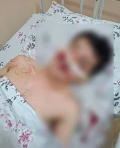 Бір топ адамның шабуылынан тұрғын ауыр жарақат алған