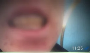 Қызылордада аяусыз соққыға жығылған оқушының анасы әділдік талап етуде