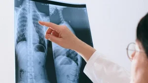 Университеттердің бірінде студенттерден туберкулез анықталды